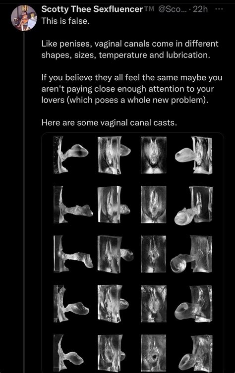 pretty vagina|Lopsided Vagina: 9 Different Labia Shapes, Colors, and Sizes